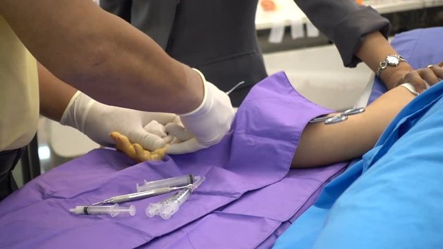 Trigger finger operation. Medical treatment , Digital flexer tenosynvitis, Stenosing tenosynvits