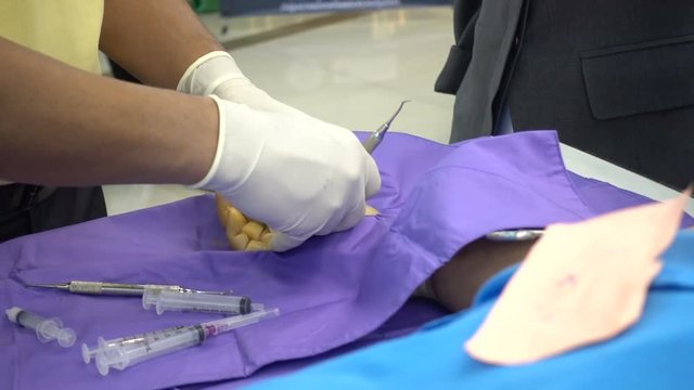 Trigger finger operation. Medical treatment , Digital flexer tenosynvitis, Stenosing tenosynvits