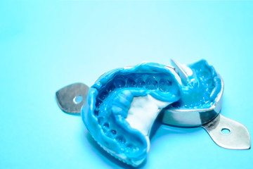Two dental impressions on a blue background with copy space. Dental molds from the upper and lower jaws of silicone material. The imprint of the tooth row of high precision. © baklykovadaria