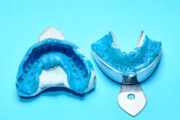 Two dental impressions on a blue background. Dental molds from the upper and lower jaws of silicone...