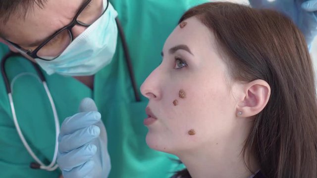 doctor examines a young woman with large moles on her face close up