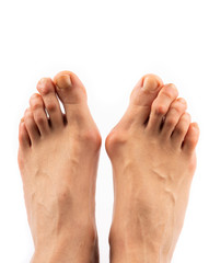 Obraz premium woman food with hallux valgus