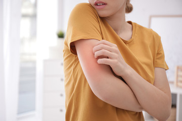 Woman scratching arm indoors, closeup with space for text. Allergy symptoms
