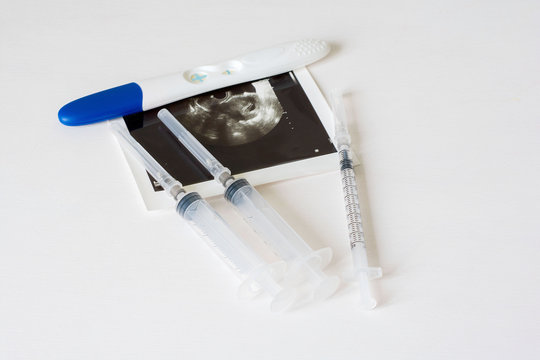 Ultrasound scan of baby and pregnancy test on white background
