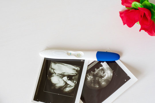 Ultrasound scan of baby and pregnancy test on white background