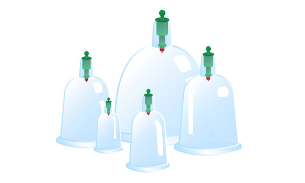 Vacuum massage cups isolated on white background. Cupping therapy glass jars of different size set. Traditional medicine methods. Sports recovery and recuperation after hard training sessions