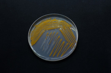 Orange colonies of Actinomyces bacteria on agar plate
