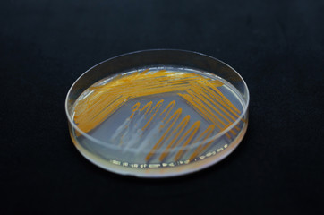Orange colonies of Actinomyces bacteria on agar plate