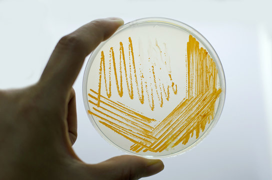 Orange colonies of Actinomyces bacteria on agar plate