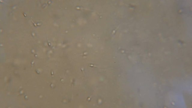 Sperm (spermatozoa) viewed under the microscope. Moving human sperm under Phase contrast Microscope. Close up showing spermatozoons. Video semen under microscope. 4K UHD
