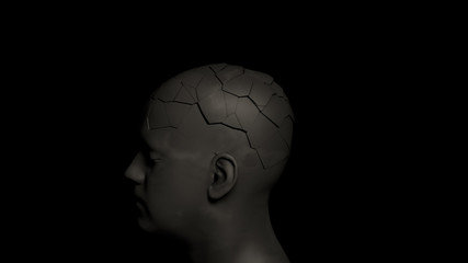 Alzheimer's disease or memory loss