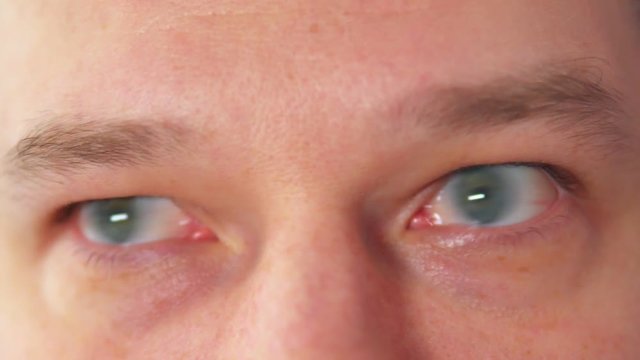 Eye movement. Eyes running from side to side