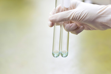 Determination of reducing sugars by Nelson-Somogyi method