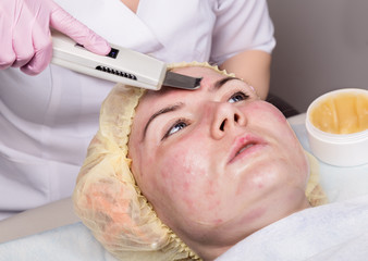 beautician at work. Ultrasonic face cleaning procedure for problem skin. Pore cleansing, oxygen saturation for woman's face