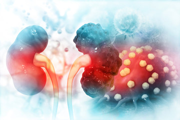 Kidney disease. 3d illustration