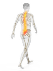 3d rendered medically accurate illustration of a walkers painful back