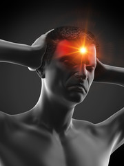 3d rendered medically accurate illustration of a man having a headache