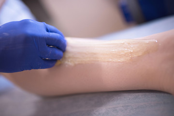 Applying a contact gel before the procedure of laser hair removal. Application of sugar paste for the procedure of shugaring.