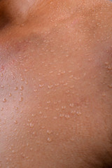 Fototapeta premium Human Skin and Sweat