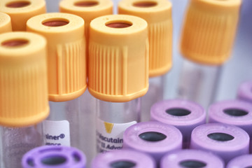 macro of test tubes with yellow top, against a gradient of white background. Selective focus