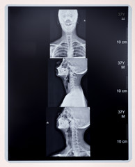 skull x-ray image
