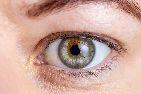 Auge