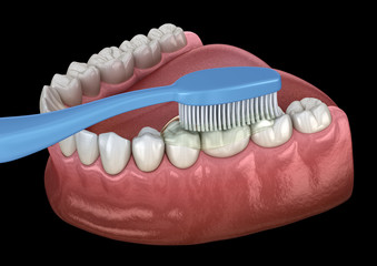 Toothbrush cleaning teeth. Medically accurate 3D illustration of oral hygiene.