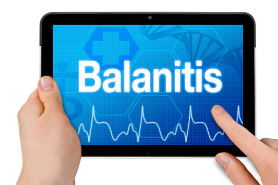 Tablet mit Touchscreen und Diagnose Balanitis
