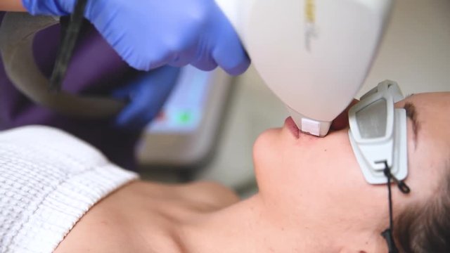 Cosmetologist does laser hair removal on the face of the patient. Epilation procedure