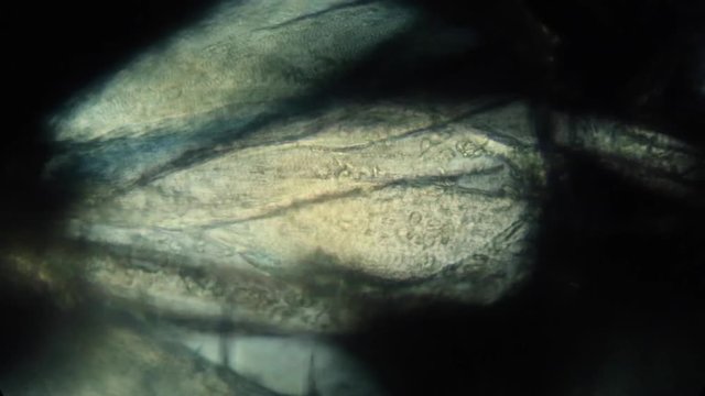 Amphipod circulation at 100x with hemolymph flow.