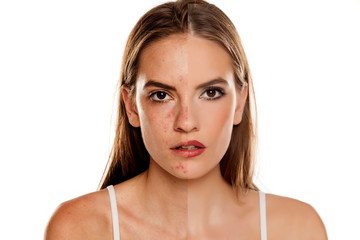 Comparison portrait of young beautiful woman before and after skin treatment and makeup on white...