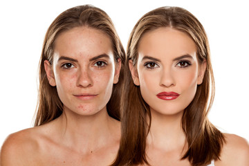 Comparison portrait of young beautiful woman before and after skin treatment and makeup on white...