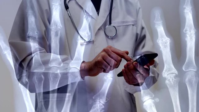 Doctor checking x-ray scan images on a smartphone. Overlay with the actual scans