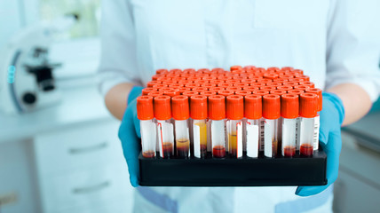 Laboratory scientist holding blood samples in a test tube rack. Blood research