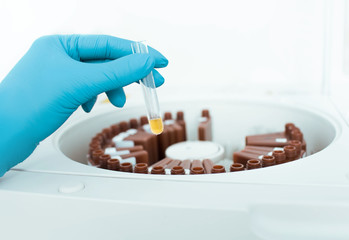 Laboratory assistant holding medical samples with blood plasma in test tube. medical research