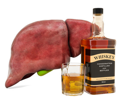 Alcohol-related liver disease, human liver with alcohol drink. 3D rendering