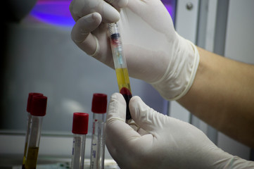 Plasma Rico en Factores
