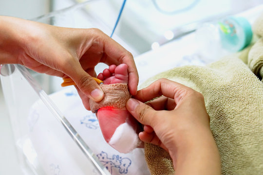 Hands Of Pediatric Nurse Using Medical Adhesive Plaster Stick And Strap To Measure Oxygen In The Blood And See The Oxygen Value For Organs On Crisis Newborn Baby Foots At NICU Wards In The Hospital.