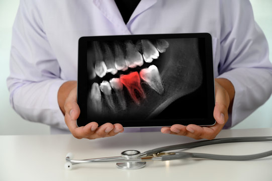 Dentist dental tool to teeth x-ray work Looking At Teeth X-ray On Computer