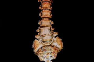 MRI  Spine image view