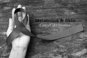 Melanoma and skin cancer black awareness ribbon on human helping hand old aged background: