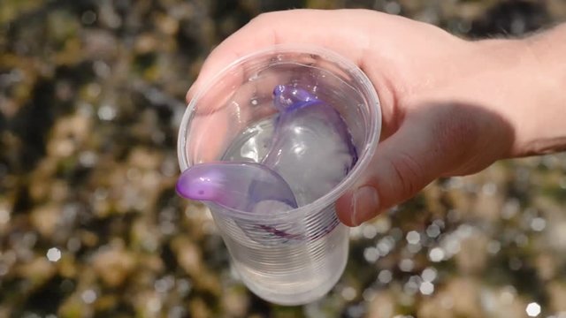 Portuguese Man Of War in a plastic cup, held by a person on the beach in Recife, Pernambuco, Brazil, after it floated up onto the beach. Still alive, transparent, dangerous and beautiful wildlife.