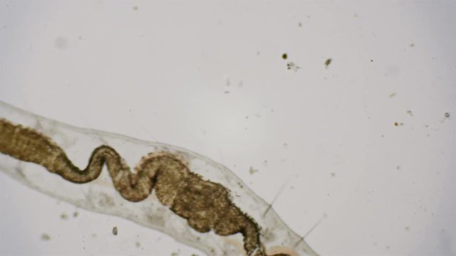 Roundworm under the microscope in 4k