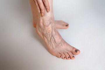 The woman rubs her tired foot. The concept of varicose veins. Close up