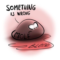 Common mole turn into melanoma