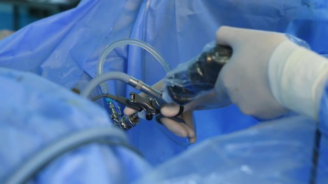 Close-up of surgeon hands performing laparoscopic surgery