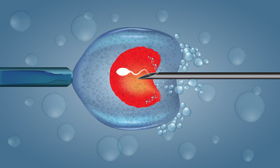 In Vitro Fertilization injection. Artificial insemination. Scientific medical illustrated vector.