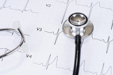 Stethoscope on the paper electrocardiogram. Medical examination