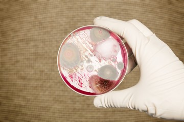 Microbiology laboratory test in scientist hand on background