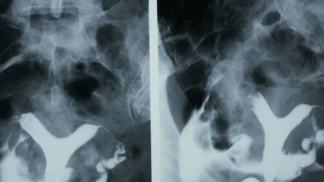 Zoom-in of the X-ray plate of pelvic bones and human spine.